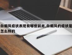 白癜风症状表现有哪些前兆,白癜风的症状是怎么样的