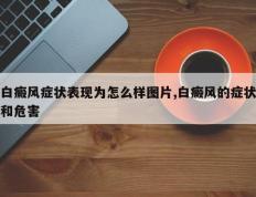 白癜风症状表现为怎么样图片,白癜风的症状和危害