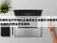 白癜风治疗药物的正确使用方法图片详解视频,白癜风药物治疗有用吗