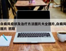 白癜风症状及治疗方法图片大全图片,白癜风图片 初期