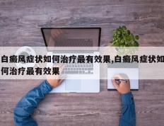 白癜风症状如何治疗最有效果,白癜风症状如何治疗最有效果