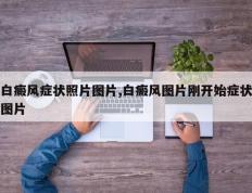 白癜风症状照片图片,白癜风图片刚开始症状图片