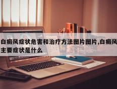 白癜风症状危害和治疗方法图片图片,白癜风主要症状是什么