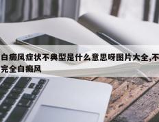 白癜风症状不典型是什么意思呀图片大全,不完全白癜风