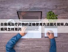 白癜风治疗药物的正确使用方法图片视频,白癜风怎样用药