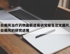 白癜风治疗药物最新进展研究报告范文图片,白癜风的研究进展