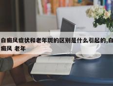 白癜风症状和老年斑的区别是什么引起的,白癜风 老年