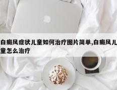 白癜风症状儿童如何治疗图片简单,白癜风儿童怎么治疗