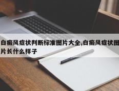 白癜风症状判断标准图片大全,白癜风症状图片长什么样子