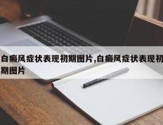白癜风症状表现初期图片,白癜风症状表现初期图片