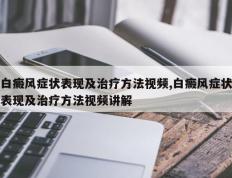 白癜风症状表现及治疗方法视频,白癜风症状表现及治疗方法视频讲解