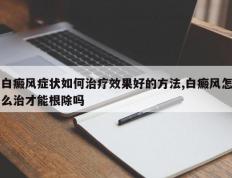 白癜风症状如何治疗效果好的方法,白癜风怎么治才能根除吗