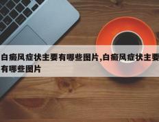 白癜风症状主要有哪些图片,白癜风症状主要有哪些图片