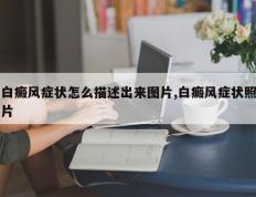 白癜风症状怎么描述出来图片,白癜风症状照片