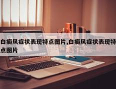 白癜风症状表现特点图片,白癜风症状表现特点图片
