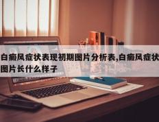 白癜风症状表现初期图片分析表,白癜风症状图片长什么样子