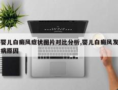 婴儿白癜风症状图片对比分析,婴儿白癜风发病原因