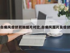 白癜风症状初期图片对比,白癜风图片及症状