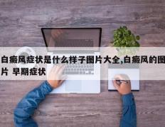 白癜风症状是什么样子图片大全,白癜风的图片 早期症状