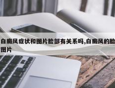 白癜风症状和图片脸部有关系吗,白癜风的脸图片