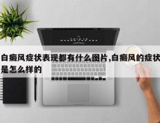 白癜风症状表现都有什么图片,白癜风的症状是怎么样的
