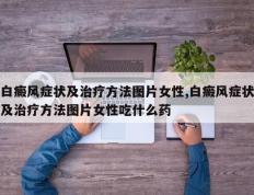 白癜风症状及治疗方法图片女性,白癜风症状及治疗方法图片女性吃什么药