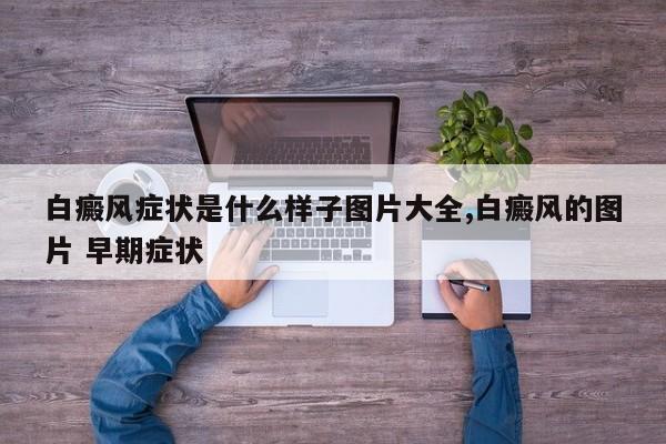 白癜风症状是什么样子图片大全,白癜风的图片 早期症状