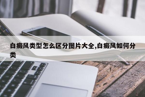 白癜风类型怎么区分图片大全,白癜风如何分类