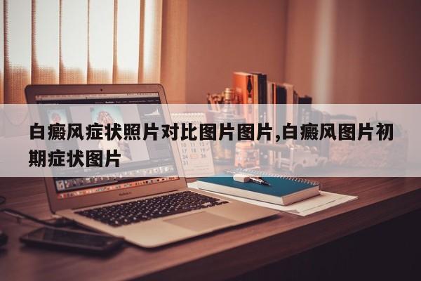 白癜风症状照片对比图片图片,白癜风图片初期症状图片