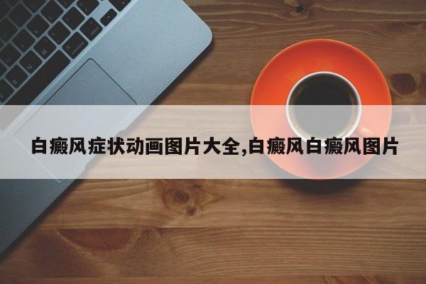 白癜风症状动画图片大全,白癜风白癜风图片