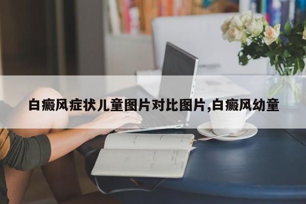 白癜风症状儿童图片对比图片,白癜风幼童