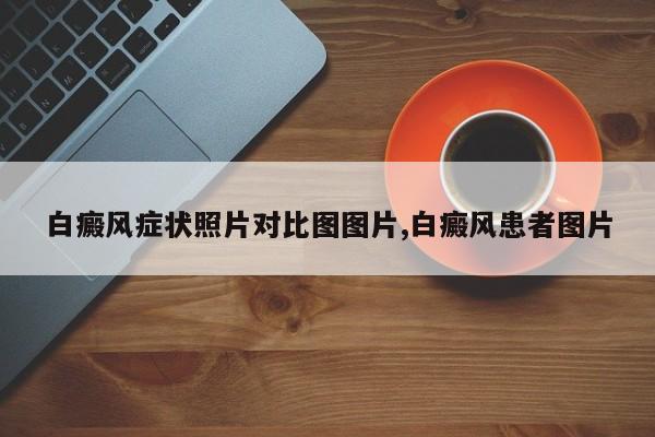 白癜风症状照片对比图图片,白癜风患者图片