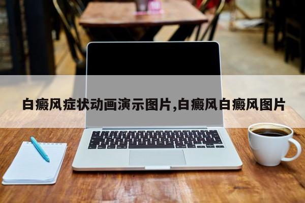 白癜风症状动画演示图片,白癜风白癜风图片