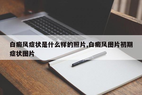 白癜风症状是什么样的照片,白癜风图片初期症状图片
