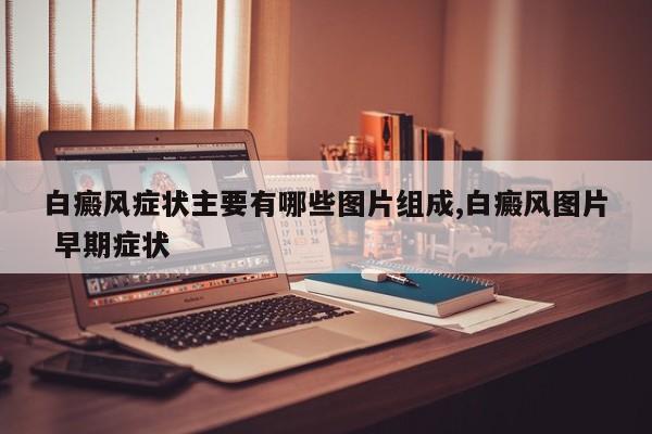 白癜风症状主要有哪些图片组成,白癜风图片 早期症状