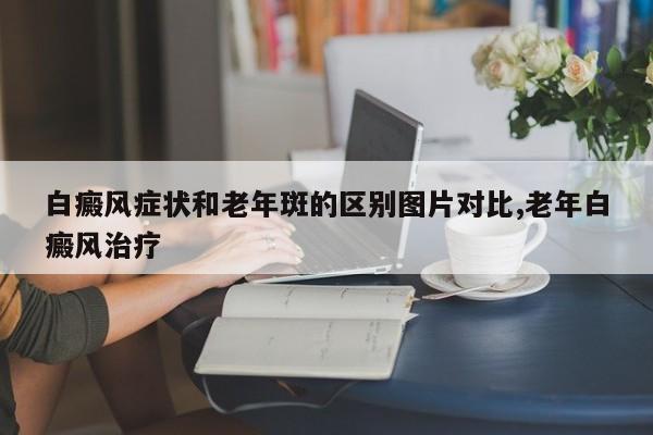 白癜风症状和老年斑的区别图片对比,老年白癜风治疗