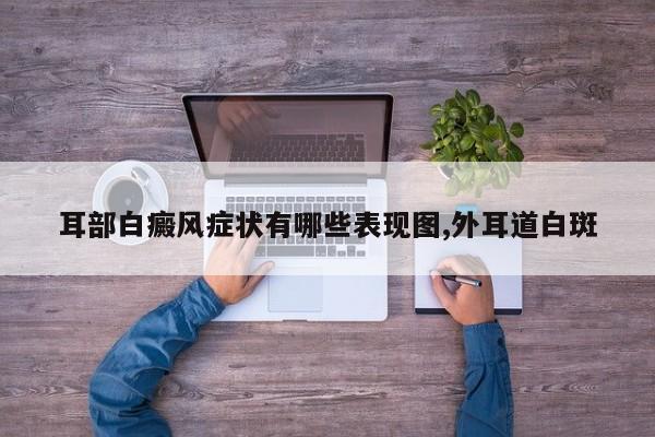耳部白癜风症状有哪些表现图,外耳道白斑