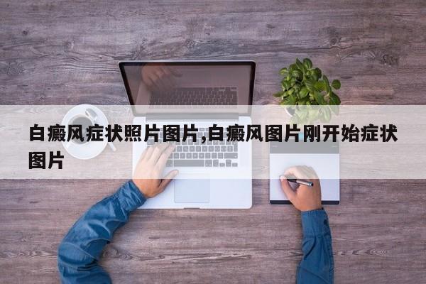 白癜风症状照片图片,白癜风图片刚开始症状图片