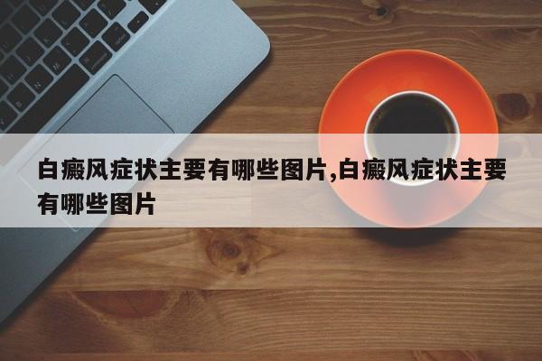白癜风症状主要有哪些图片,白癜风症状主要有哪些图片