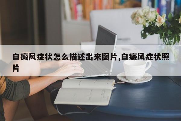 白癜风症状怎么描述出来图片,白癜风症状照片