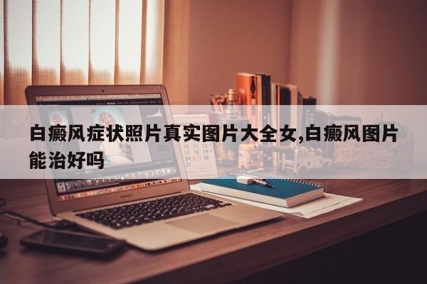白癜风症状照片真实图片大全女,白癜风图片能治好吗