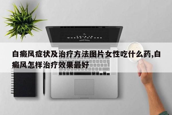 白癜风症状及治疗方法图片女性吃什么药,白癜风怎样治疗效果最好